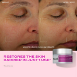 Restorative Hydro-Hyaluronic Cream