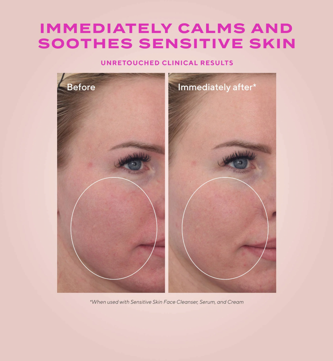 Before and after comparison of sensitive skin on a pink background with text about product effects.