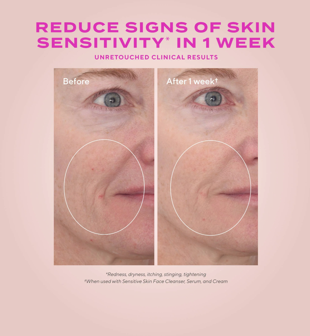 Before and after comparison of skin sensitivity reduction with text on a pink background