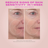 Before and after comparison of skin sensitivity reduction with text on a pink background