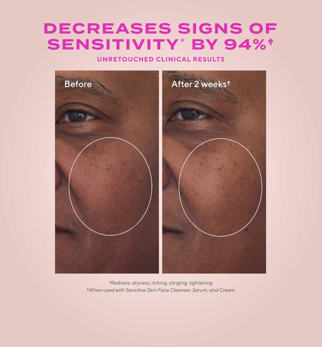 Before and after comparison of skin sensitivity reduction with text on a pink background