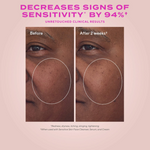 Before and after comparison of skin sensitivity reduction with text on a pink background