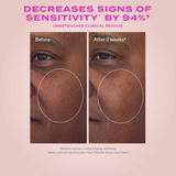 Before and after comparison of skin sensitivity reduction with text on a pink background