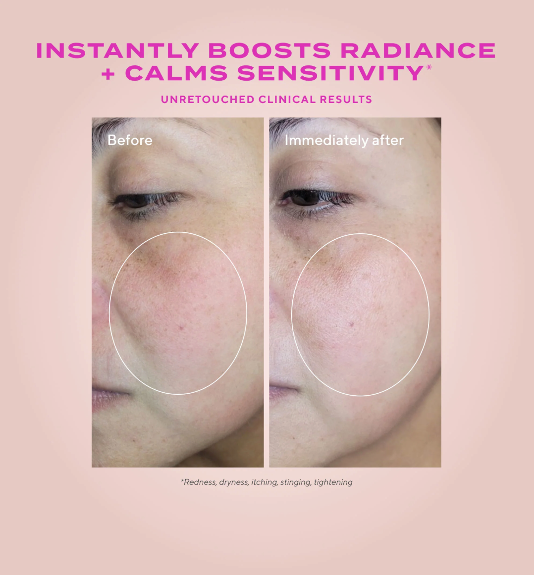 Before and after skin comparison with text about product benefits on a pink background