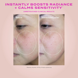 Before and after skin comparison with text about product benefits on a pink background