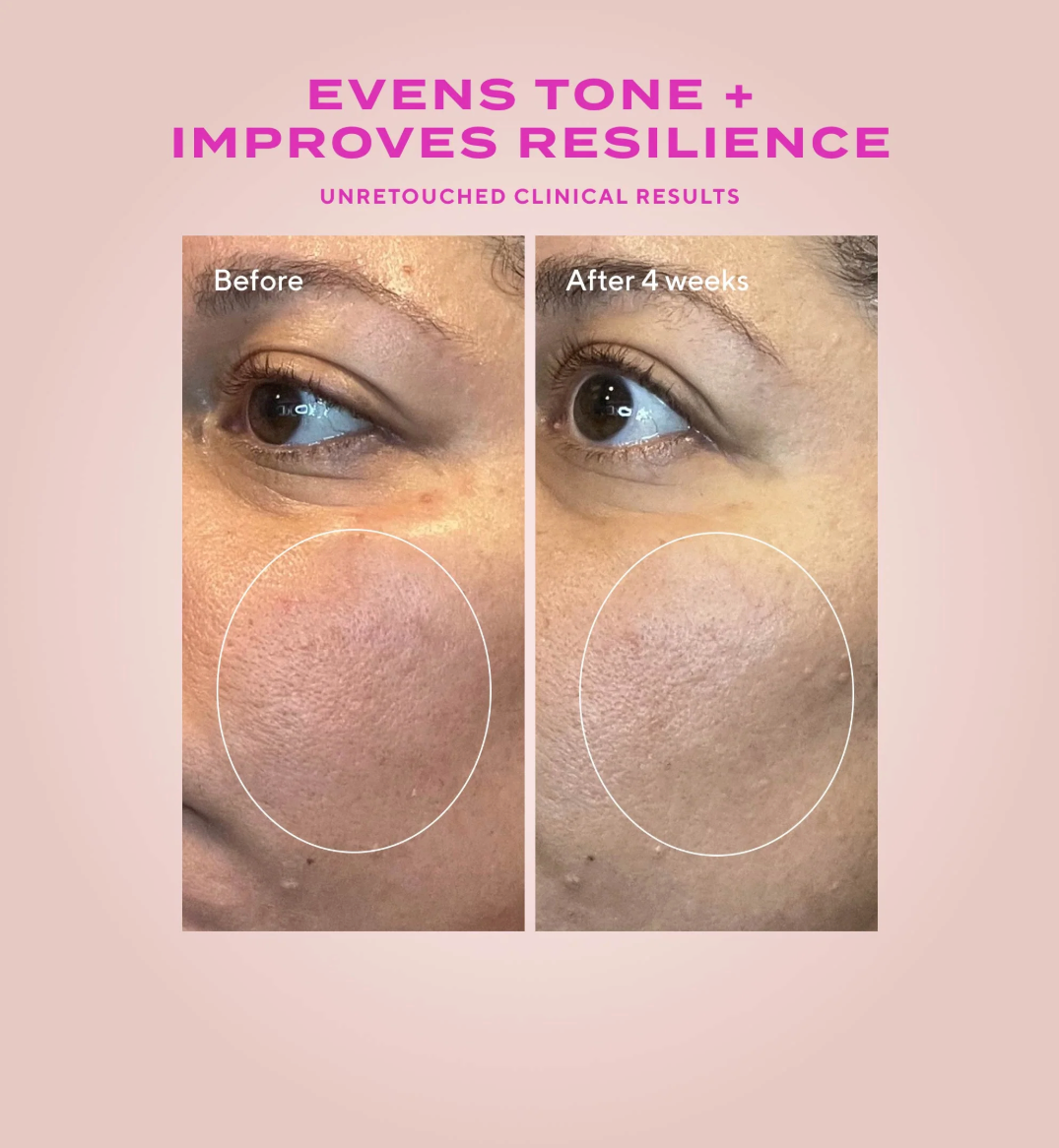 Before and after comparison of skin tone with text 'Evens Tone + Improves Resilience' on a pink background.