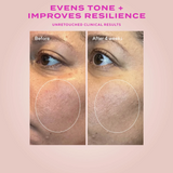 Before and after comparison of skin tone with text 'Evens Tone + Improves Resilience' on a pink background.