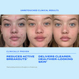Biome-Balancing Clear & Prevent Blemish Treatment Serum