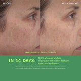 Retinol Youth Renewal Serum